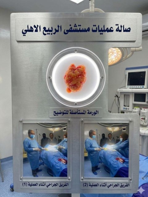عملية نوعية في مستشفى الربيع الأهلي بعد تحديث صالات العمليات